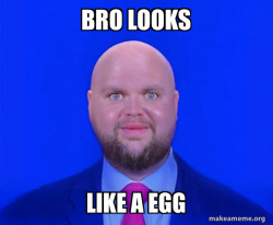 Bald J.D. Vance