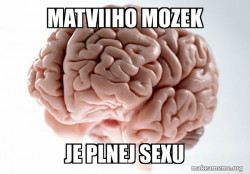 Scumbag Brain