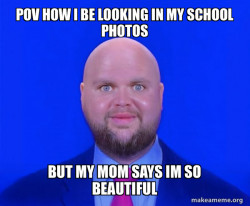 Bald J.D. Vance