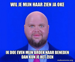 Bald J.D. Vance