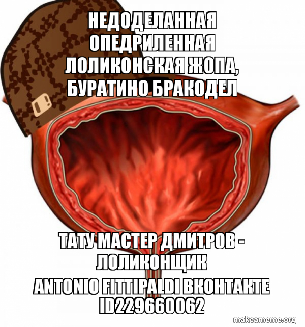 Scumbag Bladder meme