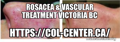 Vascular Rocacea Rosacea & vascular Treatment Victoria BC https://col-center.ca/ Meme ...